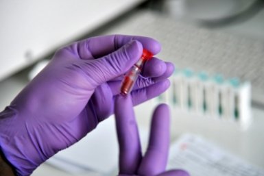 Кубанский минздрав отчитался о снижении ВИЧ-заболеваемости в регионе Юрий Гуршал