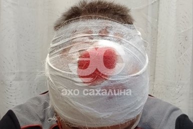 В Южно-Сахалинске мужчине прилетело бутылкой по голове, сброшенной с дома телеграм-канал &quotЭхо Сахалина&quot