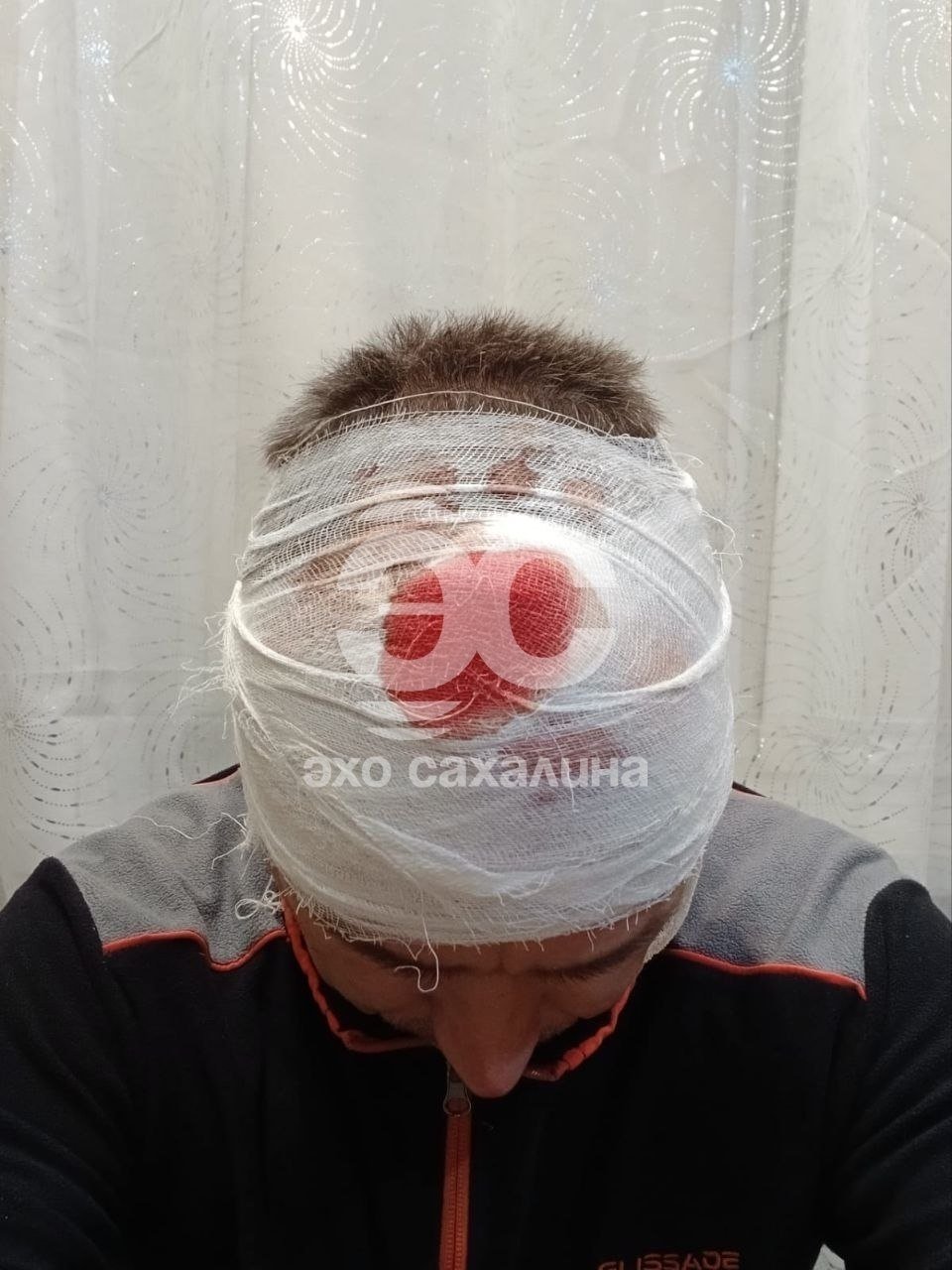 В Южно-Сахалинске мужчине прилетело бутылкой по голове, сброшенной с дома телеграм-канал "Эхо Сахалина"
